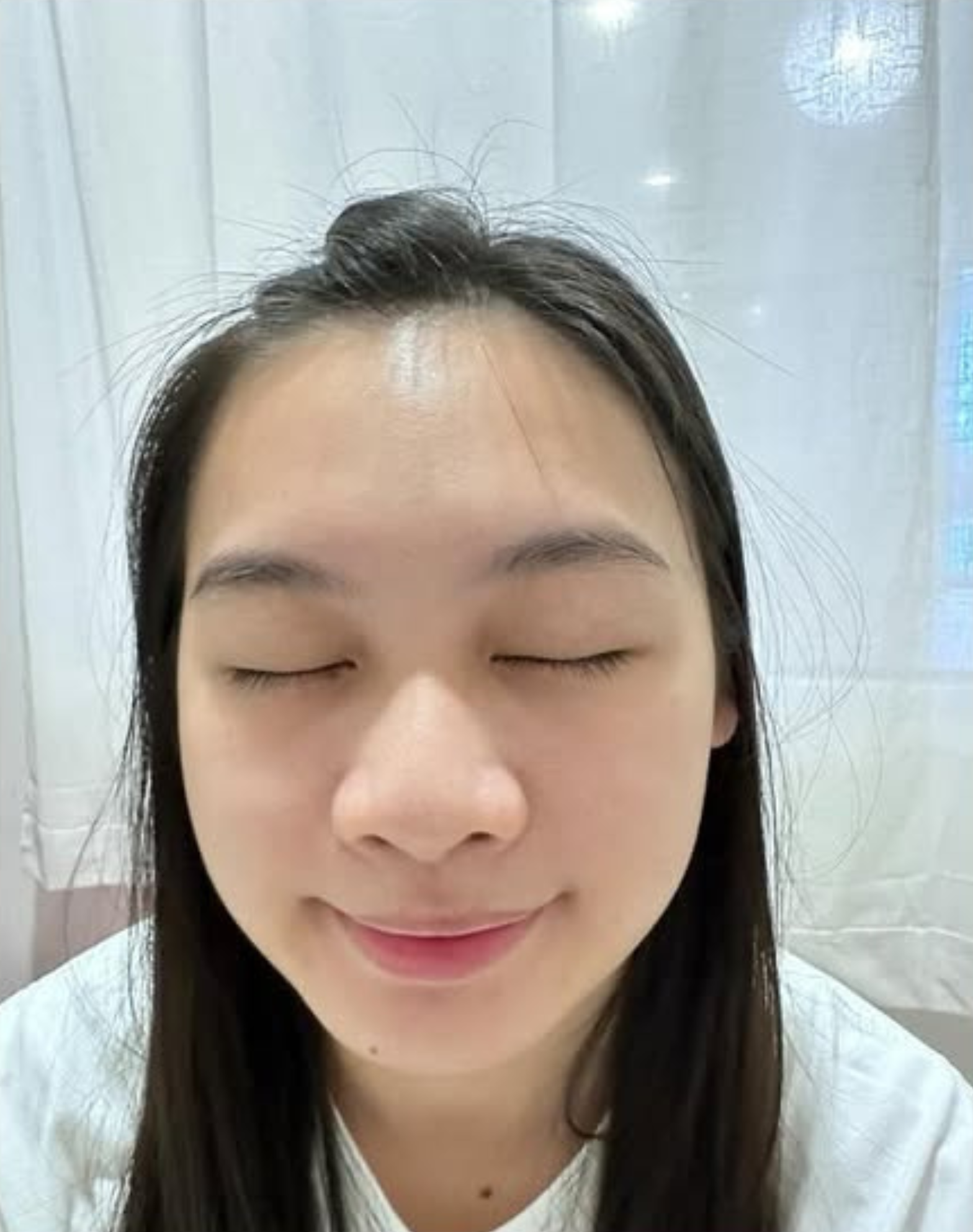 Skin after treatment
