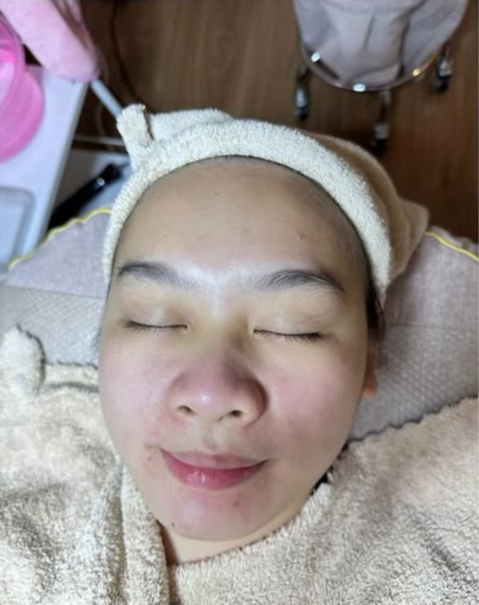 Skin before treatment